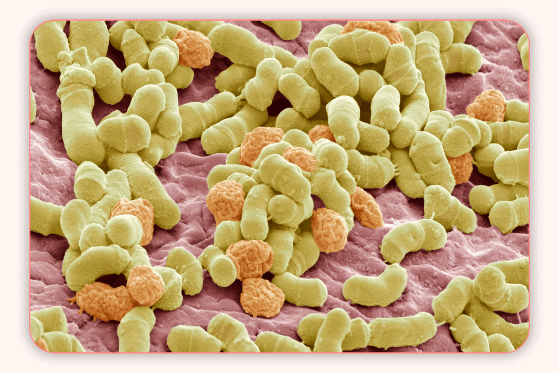 Infection à levures vs Infection urinaire : Quelle est la différence ?
