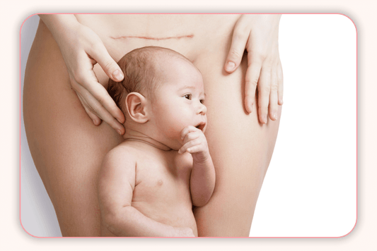Les Effets De La Césarienne Sur Le Microbiote Vaginal